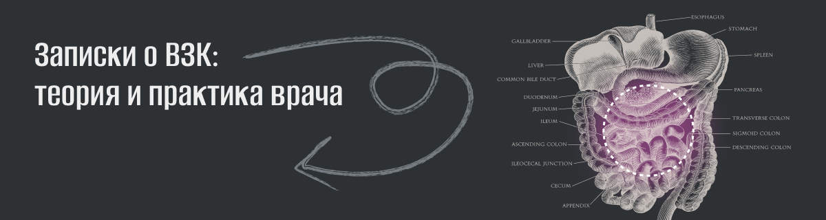 Записки о ВЗК